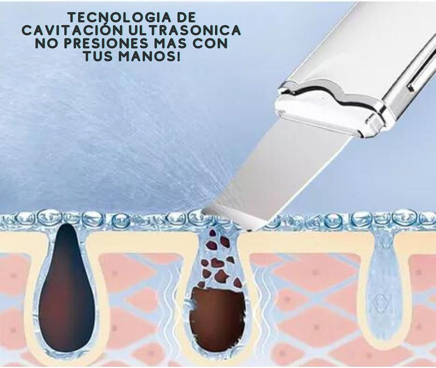 Limpiador facial 3 en 1 Espátula Ultrasónica 30% DESCUENTO ✅