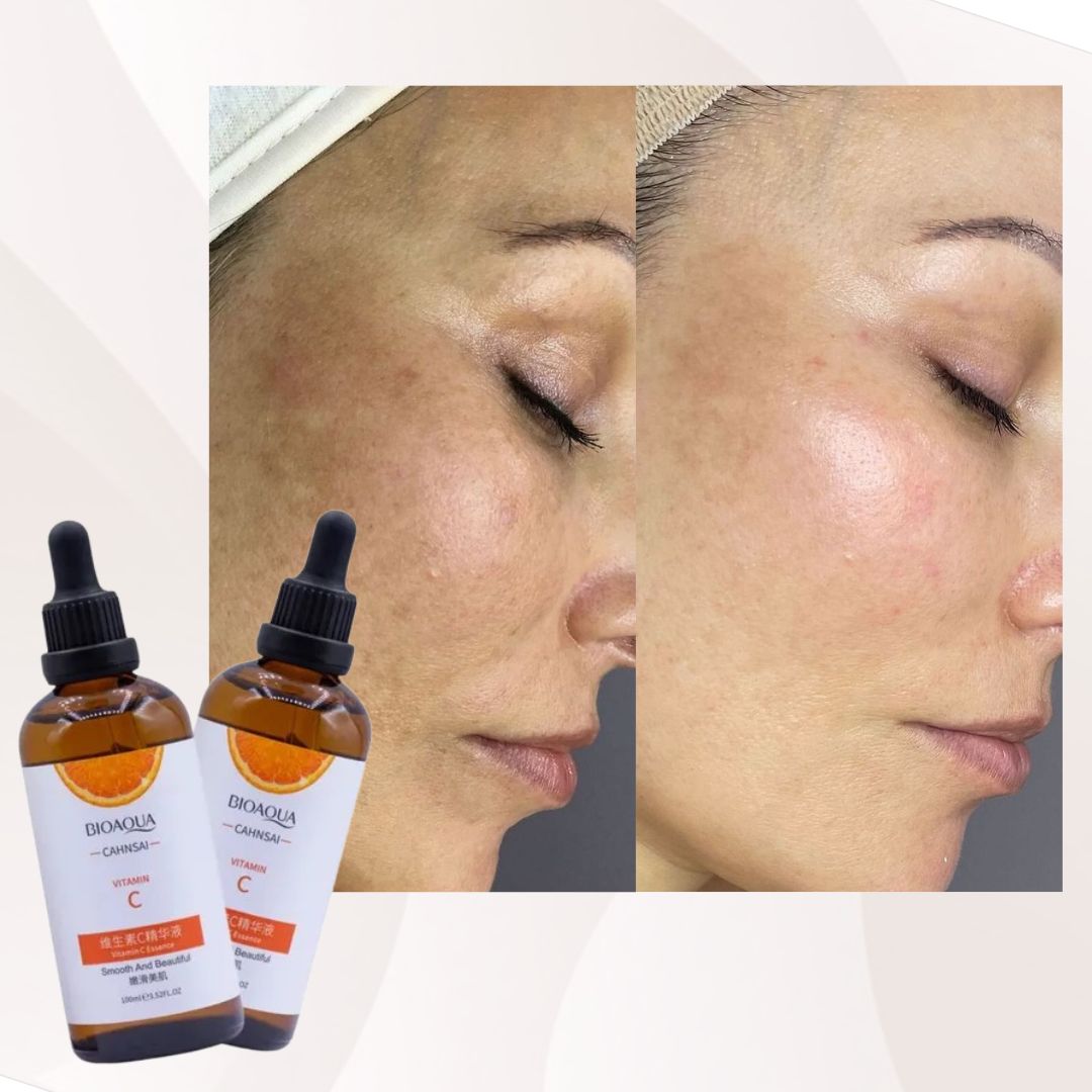 Serum Facial de vitamina C – Bioaqua x2 Unidades