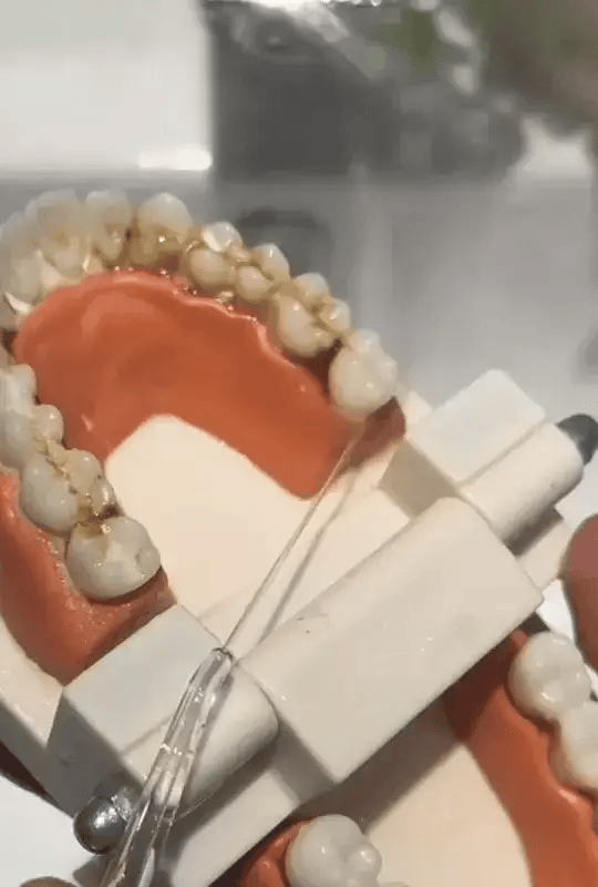 Irrigador Bucal Portatil Limpieza Dental 4 boquillas
