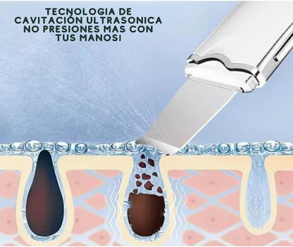 Limpiador facial 3 en 1 Espátula Ultrasónica 30% DESCUENTO ✅